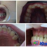 Anomalies of teeth. PHOTO 