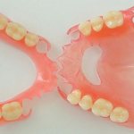 Prices of removable nylon dentures