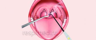 What to do if the tongue in your throat is swollen