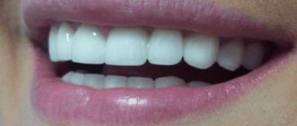 zirconium crowns for implants