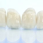 Zirconium dental prosthesis