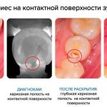 детский стоматолог спб