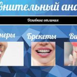 Элайнеры в сравнении с брекетами и винирами - что лучше и эффективнее?