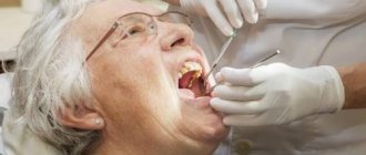 Stages of dental prosthetics