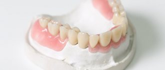 Photo of a plastic denture