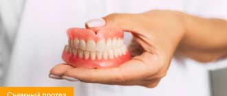 Photo of a removable denture