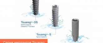 Photo of the Touareg implant series