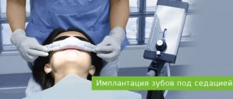 имплантация зубов под наркозом