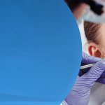 InnoDent™ – enamel restoration without drilling