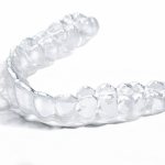 Overbite correction with Invisalign aligners