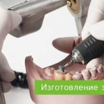 production of dentures