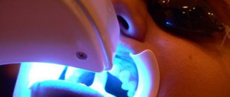 how to whiten teeth