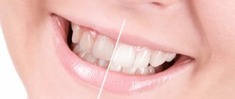 What is the safest and most effective teeth whitening?