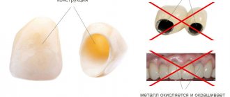 Ceramic prosthetics