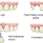 Classification of dentition defects according to Kennedy. Orthopedics 