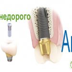 Dental implantation clinic in Moscow, promotional prices on dental-implantology.ru