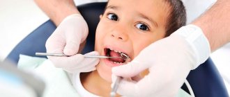 treatment of caries in children