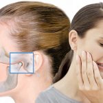 Treatment of TMJ diseases