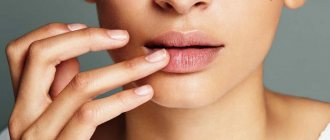 ointment for cracked lips with healing