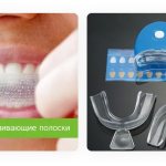 методы безопасного отбеливания зубов