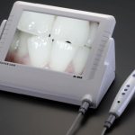 Models and functions of intraoral cameras in dentistry