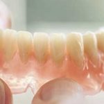 Do I need to remove dentures at night?