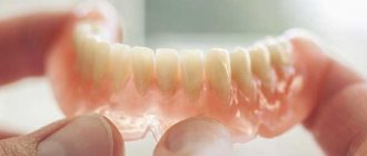 Do I need to remove dentures at night?