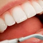 The difference between a light filling and a conventional one in dental treatment