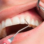 Periodontics, what is it?