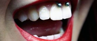 Piercing under the upper lip (smiley) on the frenulum. Photos, consequences, reviews 