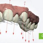почему смещаются зубы