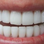 Causes of crooked jaw development and its correction