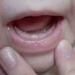 Признаки прорезывания зубов у младенца