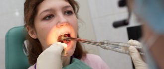 Washing tonsil lacunae in a clinical setting