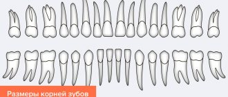 Dimensions of tooth roots in pictures