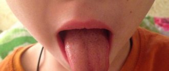 ребенок укусил язык