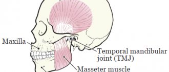 Figure 1. Bones and muscles of the jaws