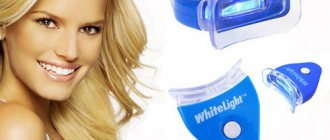 White Light home teeth whitening system