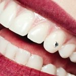 rhinestones on a person&#39;s teeth