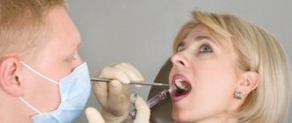 Removal of a tooth