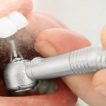 In what cases is a temporary filling placed on a tooth?