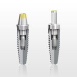 types of abutments