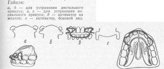 Воздействие активатора Андрезена-Гойпля на зубы